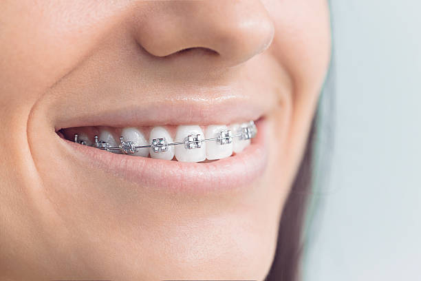 Dental Inlays and Onlays in Greenback, TN